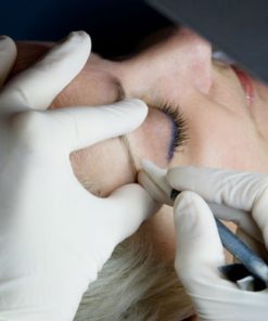 Épilation par Électrolyse