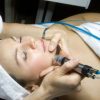 Exfoliation du visage par Microdermabrasion - Coup d'éclat