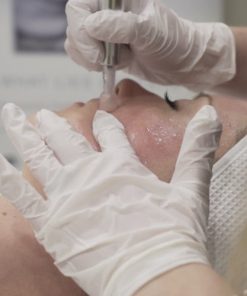 Thérapie par Micro-Aiguille