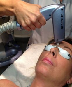 Traitement des rides profondes par laser et radio-fréquence