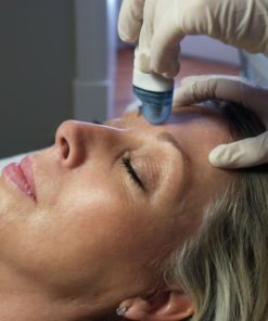 Exfoliation du visage par Microdermabrasion