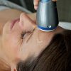 Traitement de Raffermissement du Visage par RF